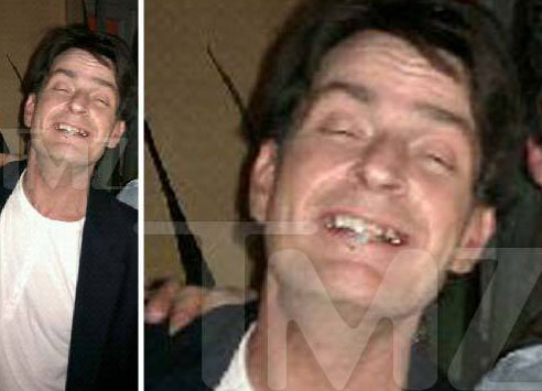 charlie sheen no teeth picture. (not)sober Charlie Sheen